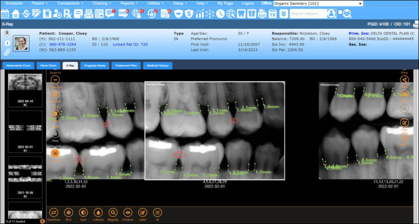 Denticon